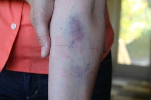 IMG_6864 IMG 6864