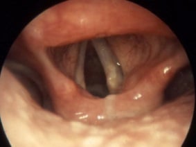 Enable image to see the Larynx