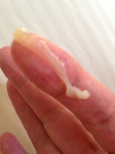 cervix plug image2