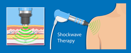 https://members.personallifemedia.com/wp-content/uploads/2022/05/Shockwave-Therapy.png