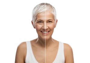 Skin Progress: Facial Comparison Results
